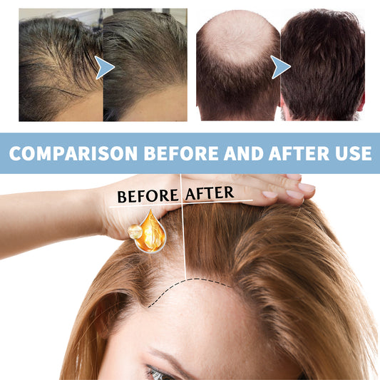 EELHOE Thick Hair Foam Shampoo Cleansing Scalp Moisturizing Volumizing Hair Strengthening Fluffy Smooth Shampoo